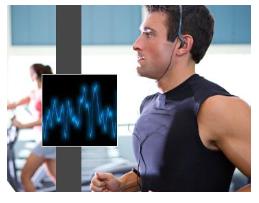 cardiac exercise treadmill stress testing